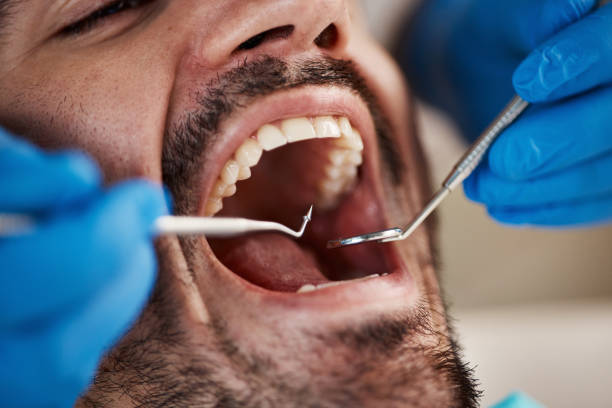 Best Urgent Dental Care for Toothaches in Delphos, OH