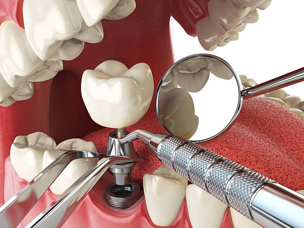 Professional Emergency Dental Service in OH